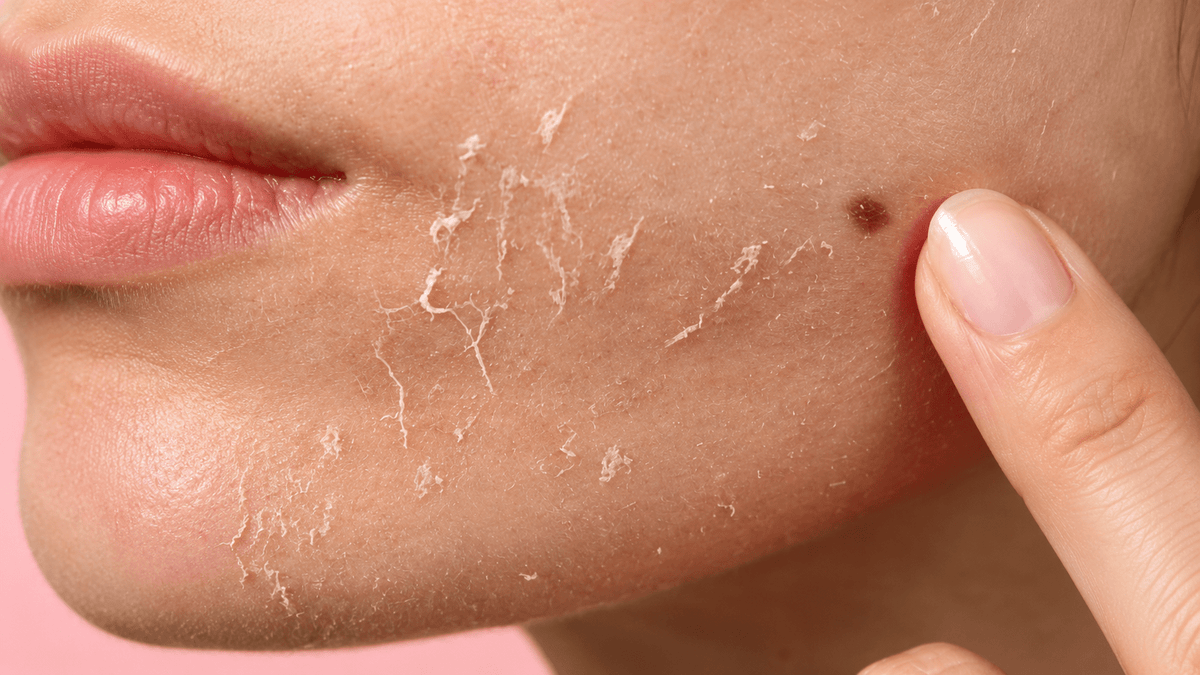 How to Smooth Dry, Flaky Patches on Your Face