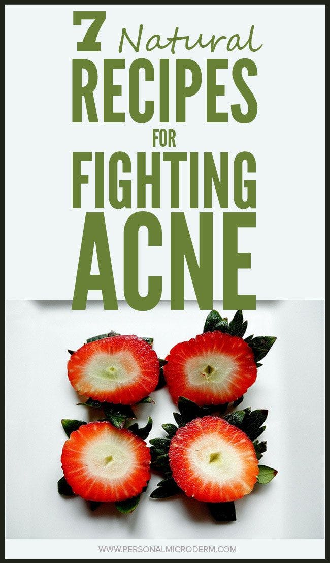 7 Natural Recipes For Fighting Acne