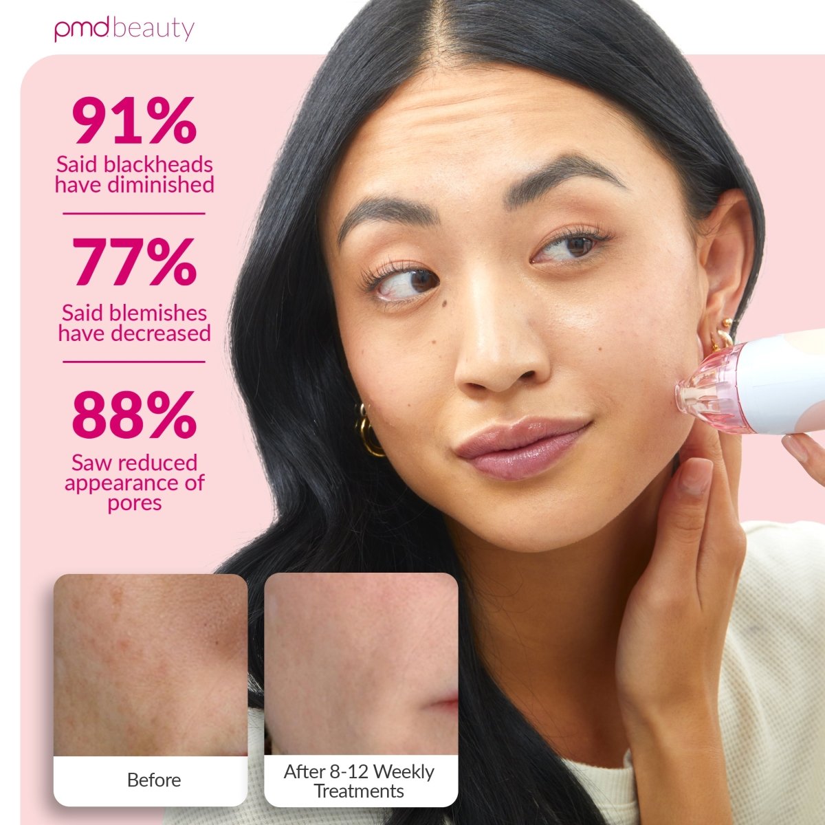 Personal Microderm Classic