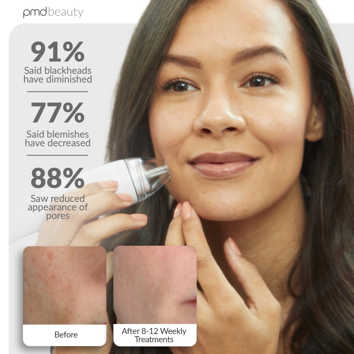 Personal Microderm Pro