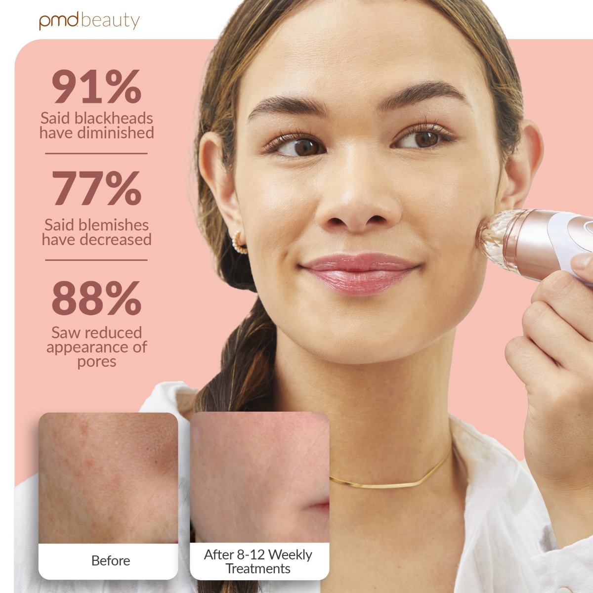 Personal Microderm Elite Pro