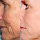 Personal Microderm Pro