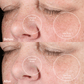 4002-RoseG? Before and Afters With the PMD Clean Pro Gold